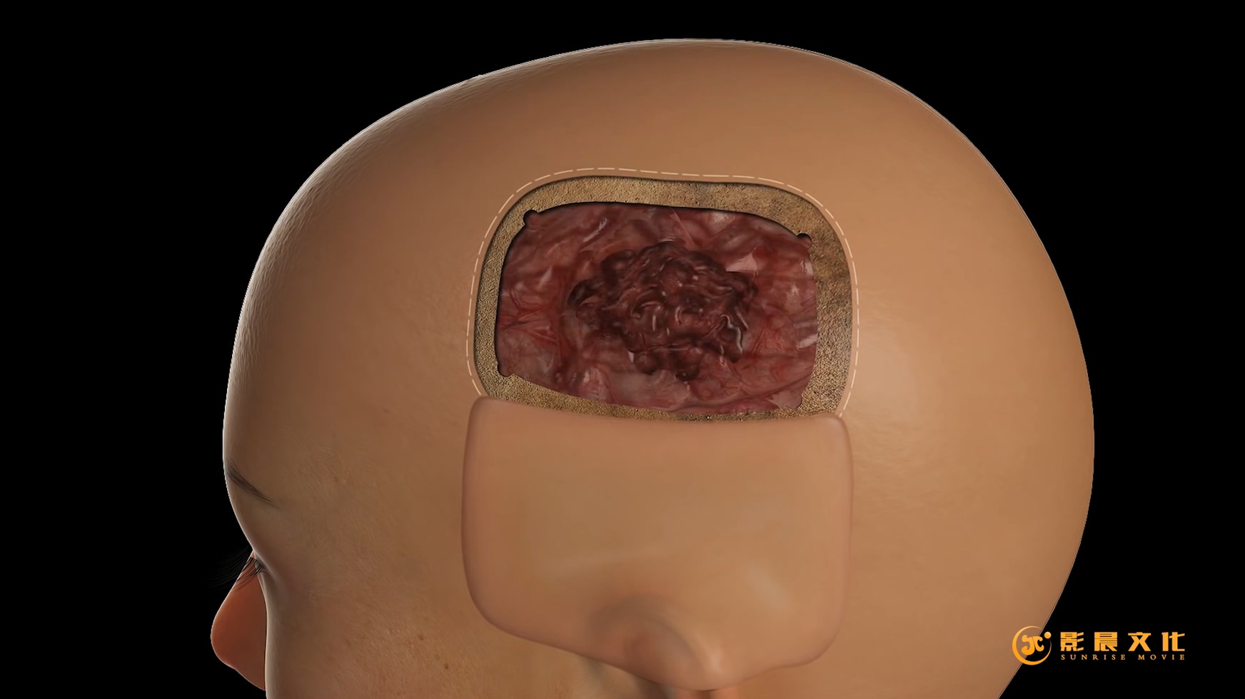 廣州醫(yī)療三維動畫