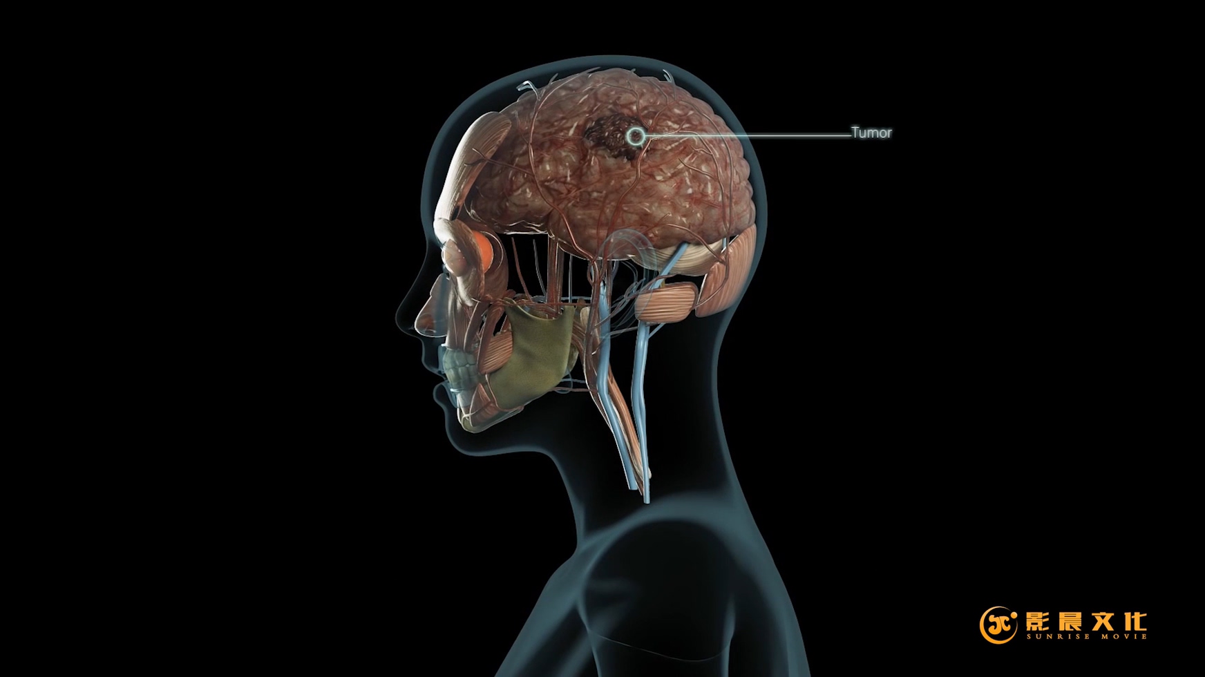 廣州醫(yī)學(xué)三維動(dòng)畫宣傳片制作在醫(yī)學(xué)行業(yè)的價(jià)值