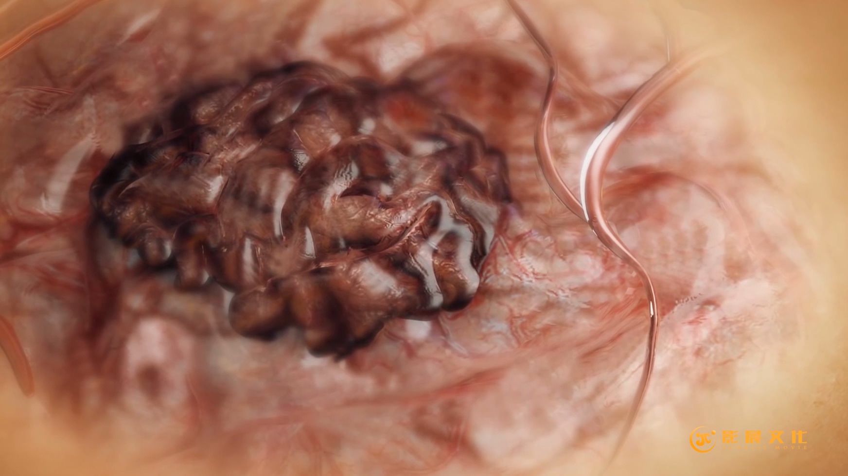 廣州醫(yī)療三維動畫